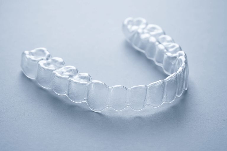 Aligneur transparent utilisé pour le traitement orthodontique discret à Nyon